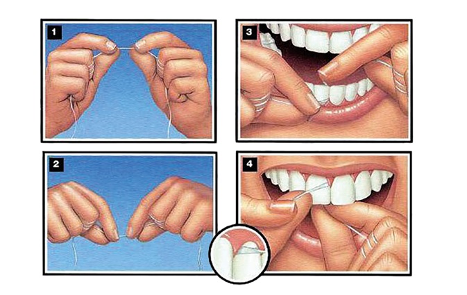 Diş İpi Kullanımı