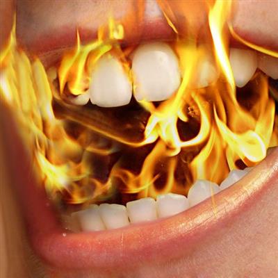 Burning Mouth Syndrome | British Association of Oral and Maxillofacial  Surgeons
