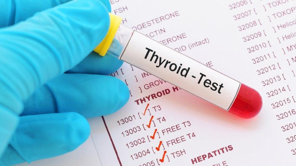 T3-T4 tiroid fonksiyon testleri nedir? T3-T4 değerlerinin yüksekliği ve  düşüklüğü ne anlama gelir? - Son dakika sağlık haberleri – Sözcü