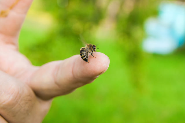 Arı Sokması Nedir? Arı Sokmasına Ne İyi Gelir? | Balparmak