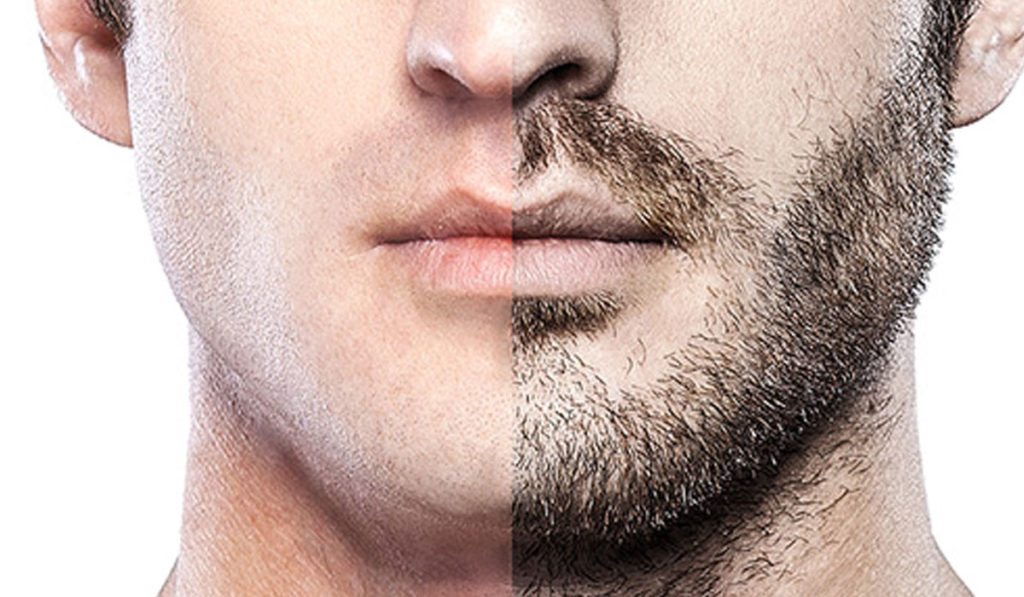 sakal nasıl çıkar doğal